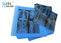 الأشعة الأزرق X راي التصوير الطبي فيلم 210um سمك للطابعة إبسون النافثة للحبر