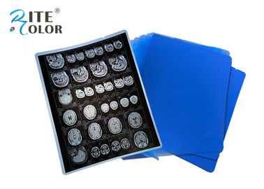 PET Base X Ray Sheet فيلم التصوير الشعاعي فيلم ل DR CT 100 ورقة لكل علبة