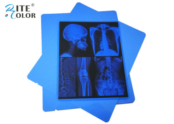 الفيلم الطبي للأشعة السينية من نوع A4 Blue PET Dry Pigment Inkjet