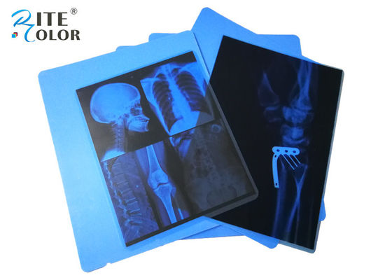 Inkjet PET Medical Imaging Blue X Ray Film لطابعات Canon Pixma